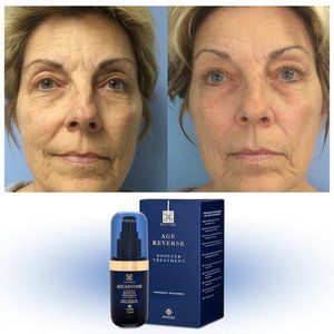 AGE REVERSE BOOSTER TREATMENT